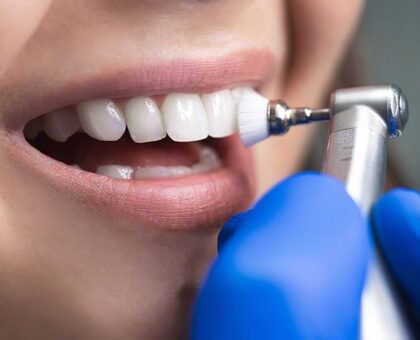 Cosmetic Dentistry